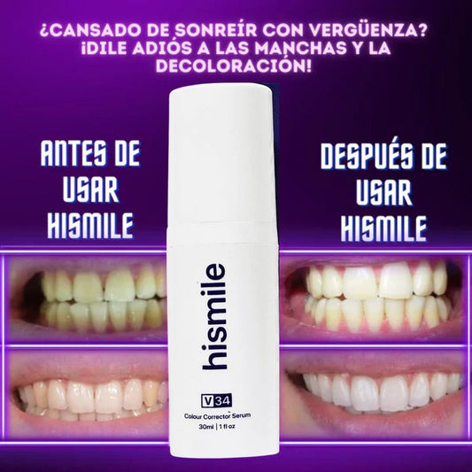 Crema Blanqueadora Dental V34 🦷 + Envío gratis 🚚